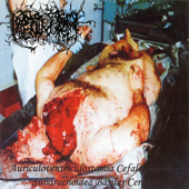HIPERMENORREA (Mex): “Auriculoventriculostomia Cefalorraquidea Subaracnoidea Basilar Cerebral” split Cd with EXCREMENT (Mex) 2006 Alarma!